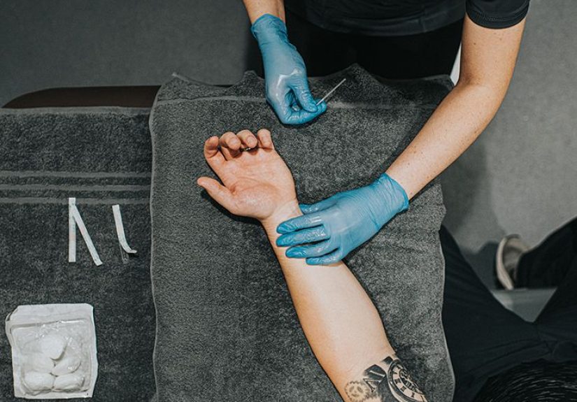 Acupuncture and constipation: Can it help?