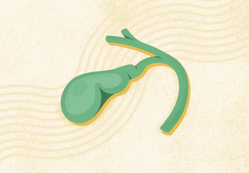 What Are Common Gallbladder Problems? Symptoms, Causes, Diagnosis, Treatment, and Prevention