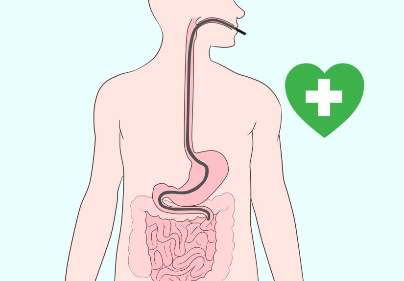 3 Easy Ways to Test for Lactose Intolerance