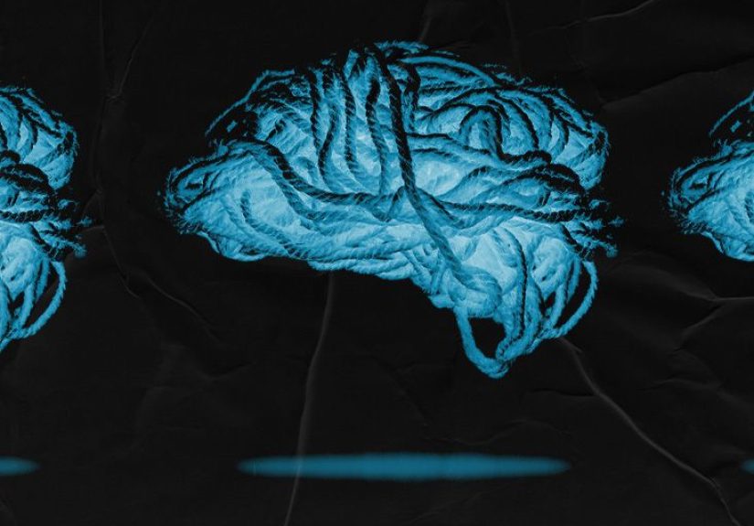 Cerebrovascular accident: Stroke types, symptoms, causes