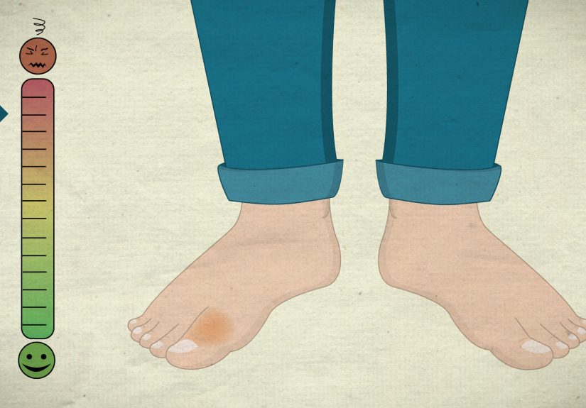 How to Know if Your Toe Is Broken: Advice from a Foot Surgeon