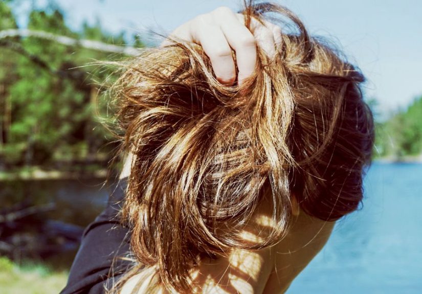 Psoriasis and Hair Loss: Is There a Connection?