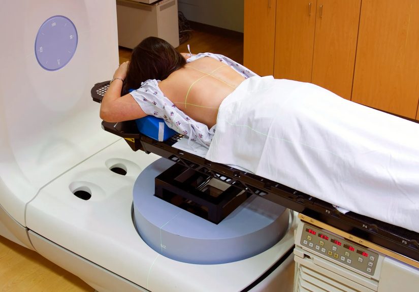 Side-Effects of Radiation Therapy for Cancer Treatment