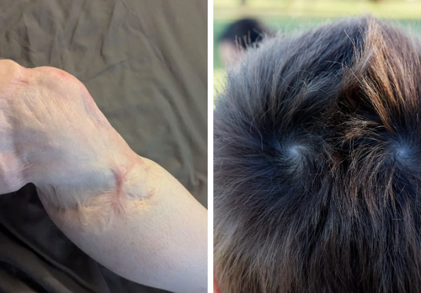 "Unable To Grow Nails": 50 Fascinating And Wild Things That Can Happen To The Human Body