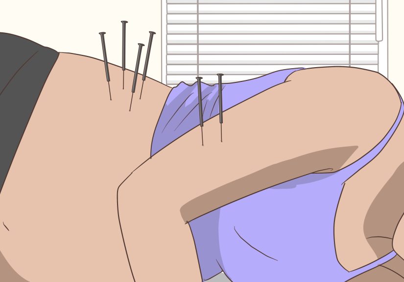 3 Ways to Relieve Sciatica Pain During Pregnancy