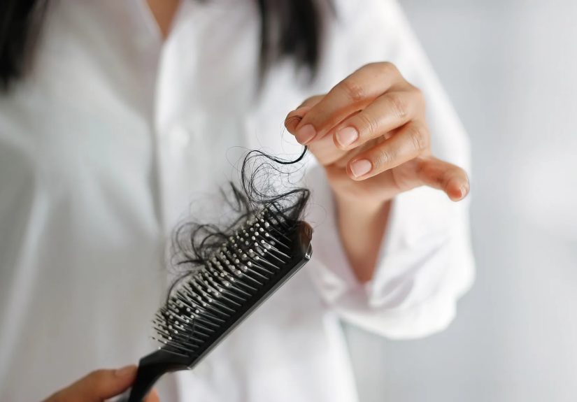 Best Treatments for Thinning Hair: What Really Works?