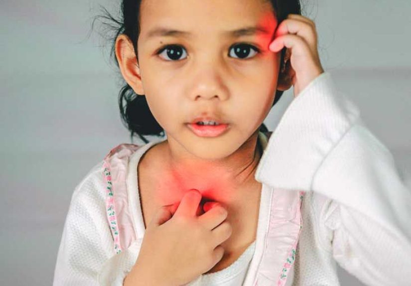 Café au Lait Spots: In Babies, Differential Diagnosis, and More