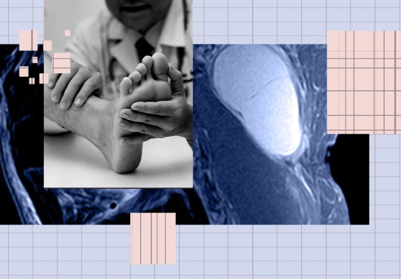 Cysts: Types, pictures, symptoms, causes, and treatment