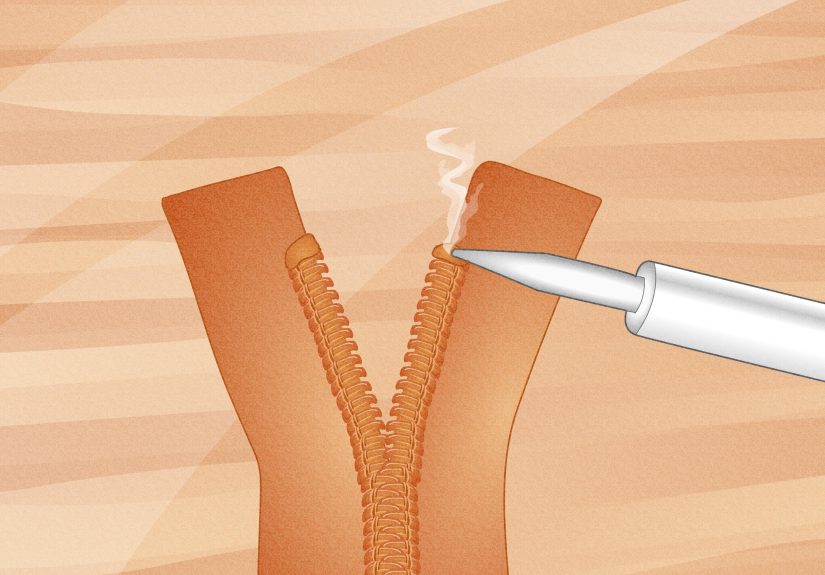Easy Ways to Repair an Invisible Zipper: 13 Steps