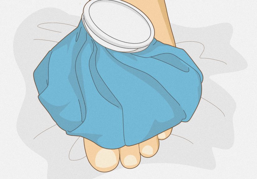 How to Pop a Blood Blister: 11 Steps