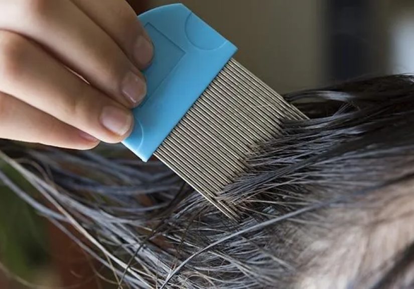 How to Treat and Prevent Lice