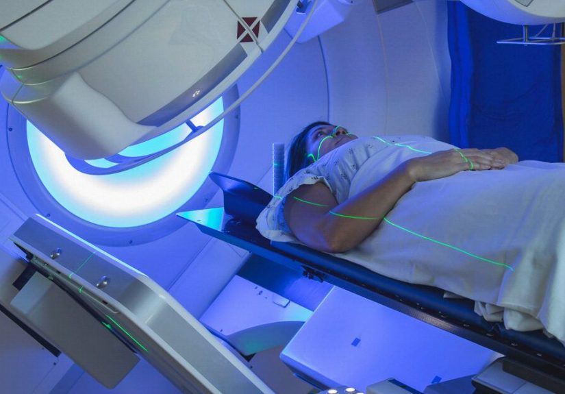 Inoperable Lung Cancer: What to Expect