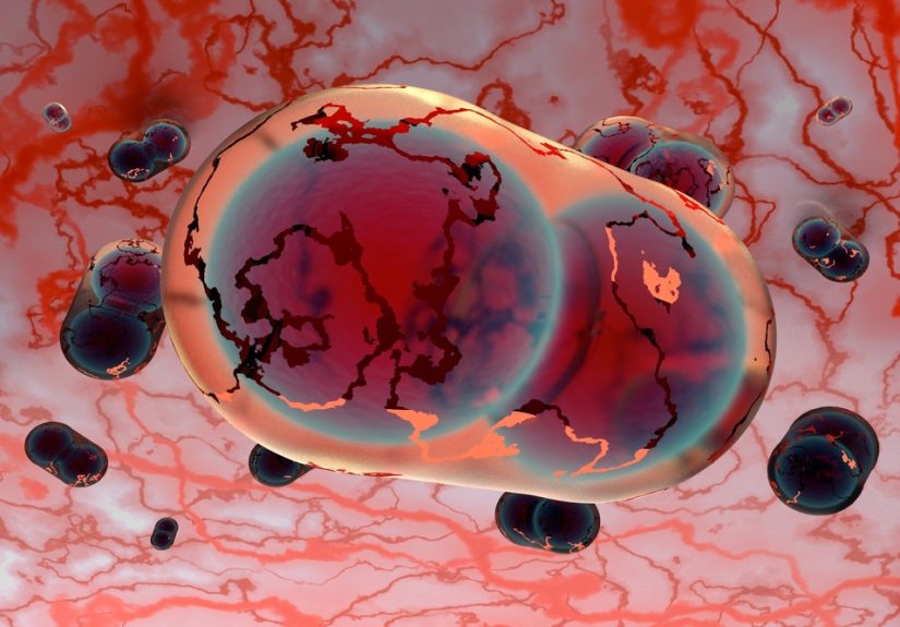 Is Smallpox Set for a Comeback?
