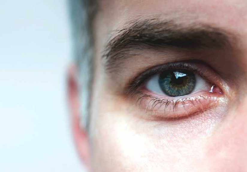 Mydriasis: Causes, Treatment, and More