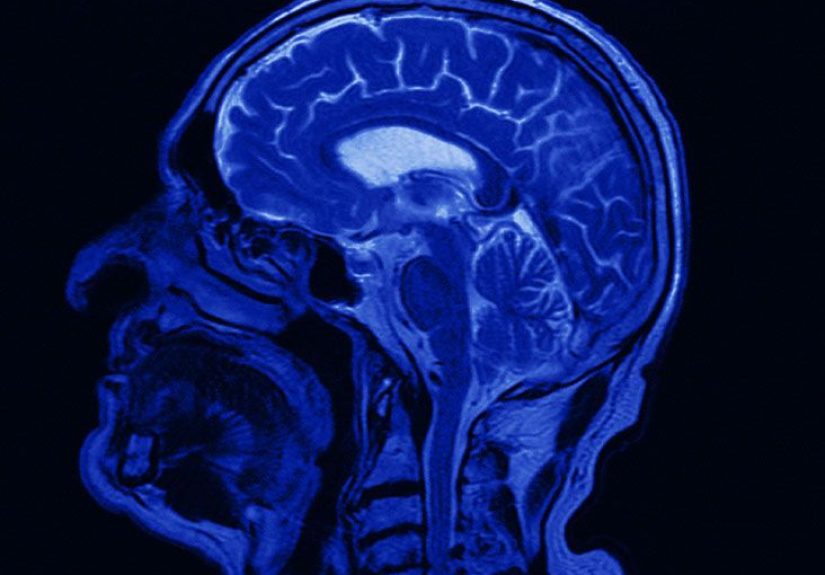 Pituitary adenoma treatments: Surgery, medication, radiation