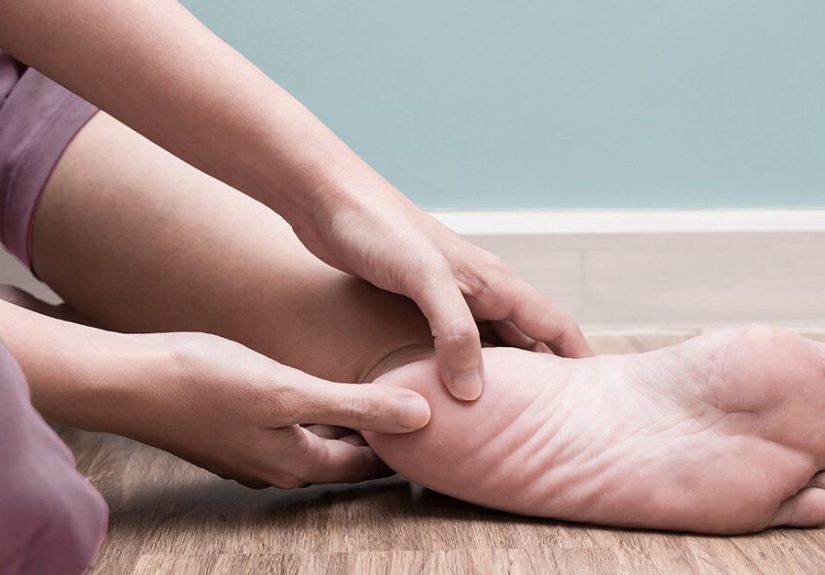 Plantar Fasciitis Surgery: Procedure, Success Rates & Recovery