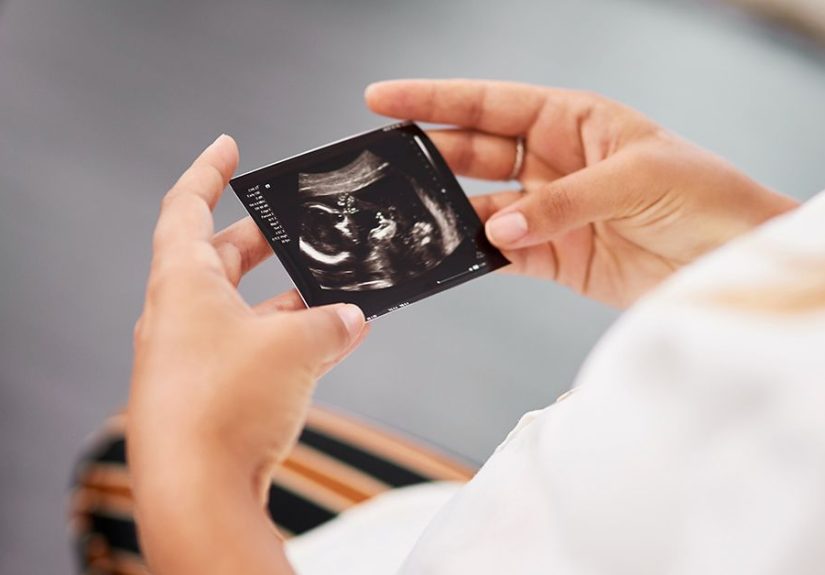 SMA Type 0: What it is, Symptoms, Diagnosis, and Life Expectancy