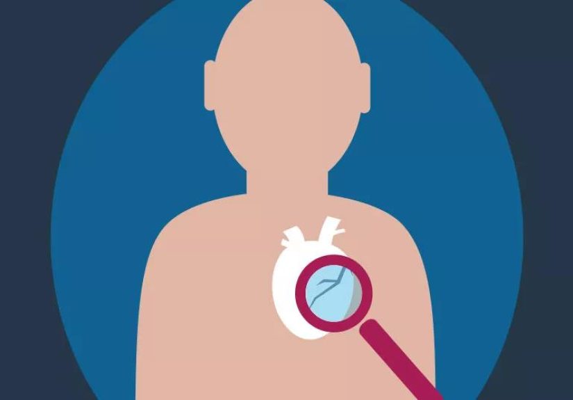 Sudden Cardiac Arrest: 5 Things Raise Your Risk