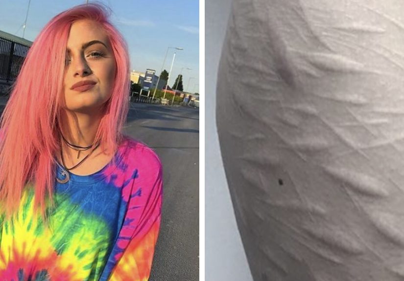 A Young Adult Found a Tattoo Artist  But the Bigger Story Is Healing First