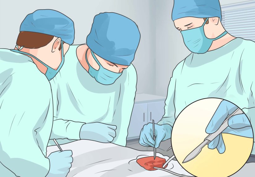 How to Treat a Foot Fracture