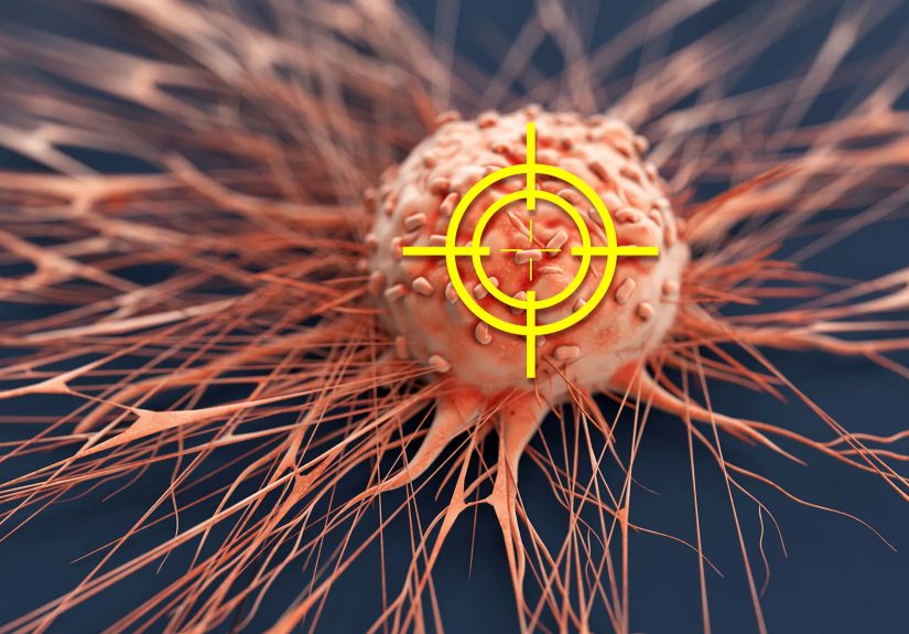 Metastatic Breast Cancer: How Targeted Therapies Work